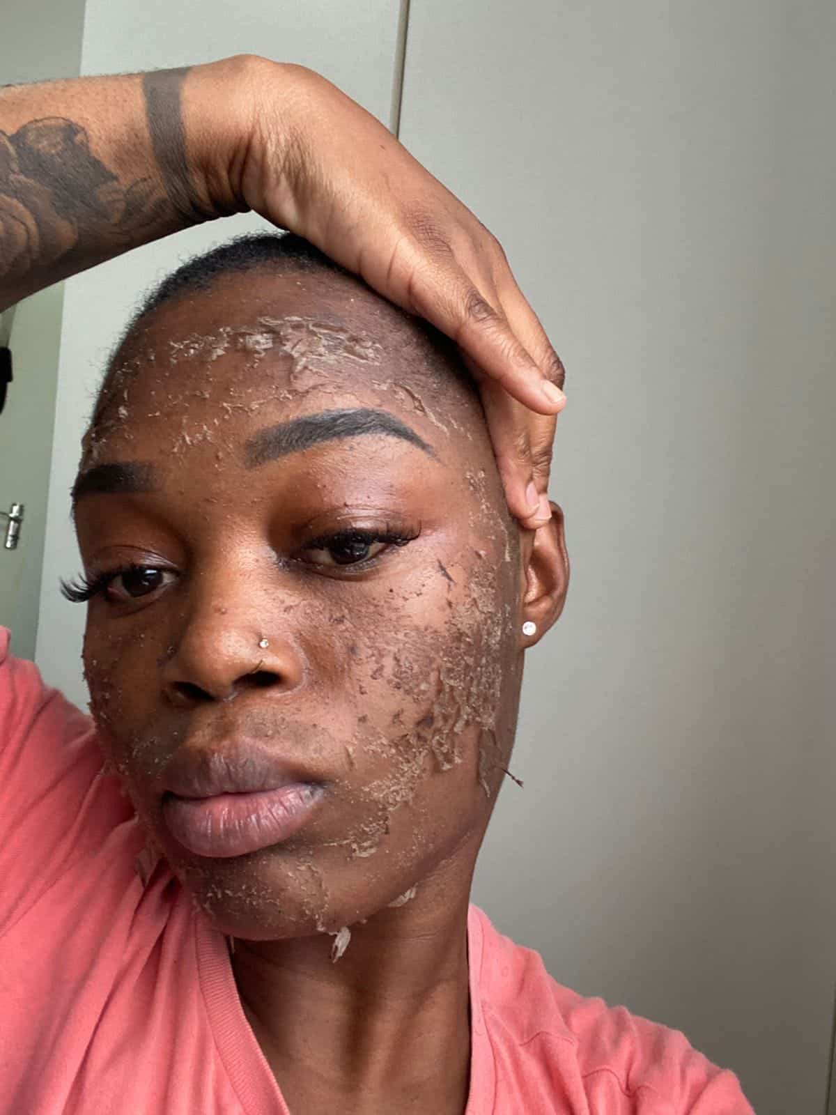 Before algae peel